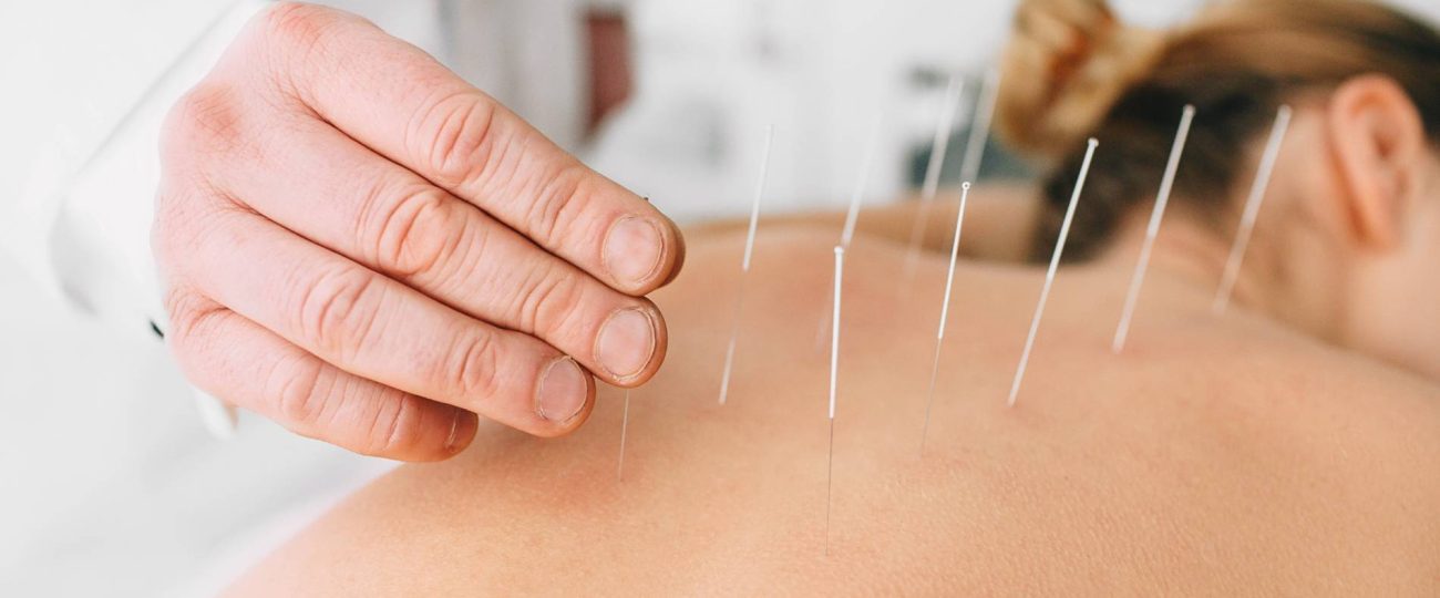 The Healing Art of Acupuncture: Unlocking Ancient Wisdom