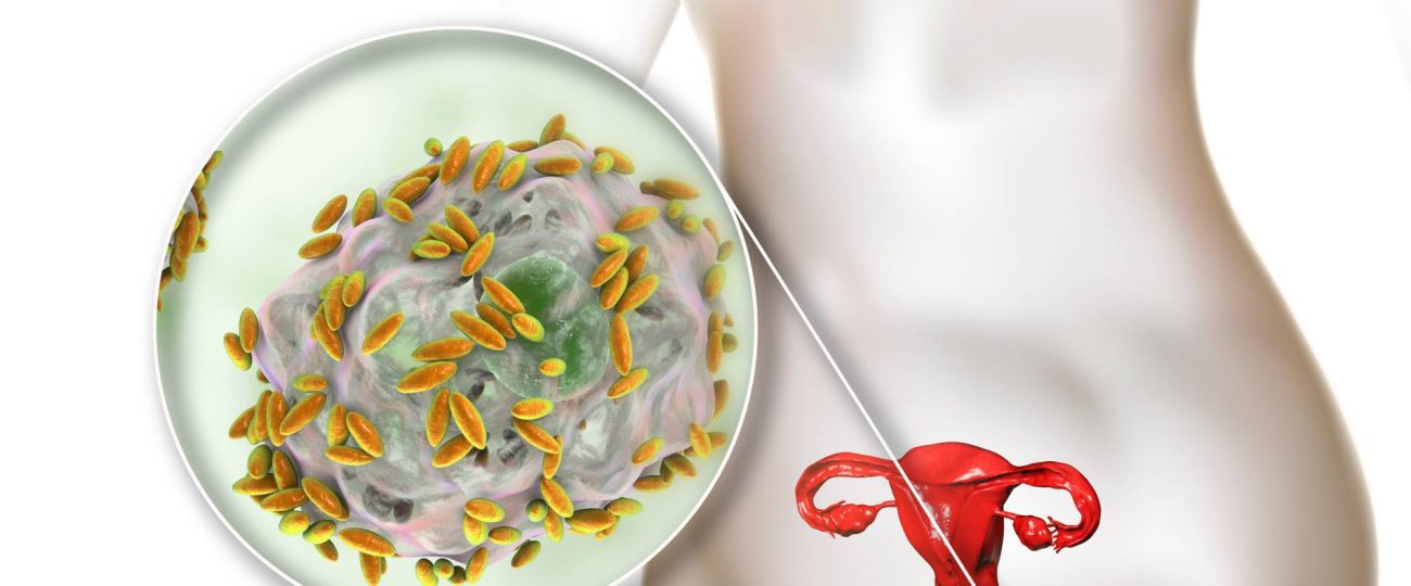 Understanding Bacterial Vaginosis: Prevention and Awareness