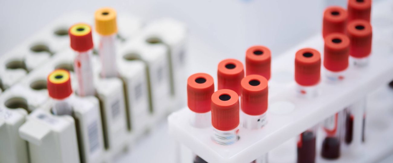 Comprehensive Guide to Swab Drug Tests: Accurate and Convenient Drug Screening