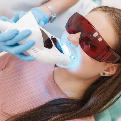 Methods of Teeth Whitening: Achieving a Bright and Beautiful Smile